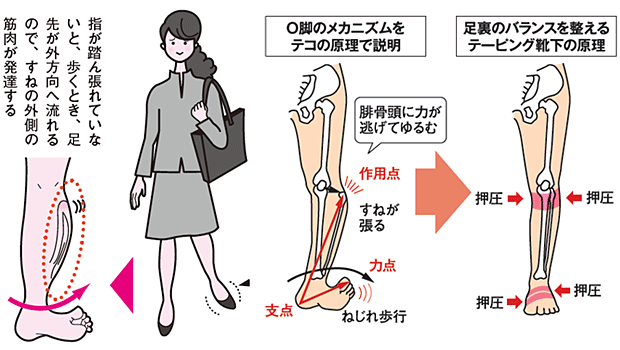 O脚のメカニズムとテーピング靴下の原理