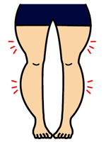 ひざ下と股関節Ｏ脚