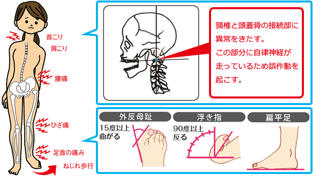 足と首の異常の構造